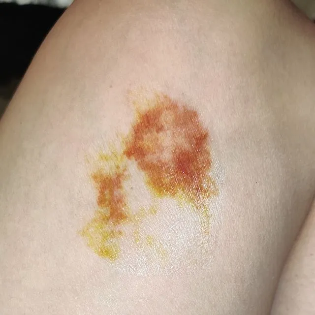 BIG BRUISE (A)TATTOO (halloween Special effect makeup, transfer, Fake scar / wound temporary tattoo)